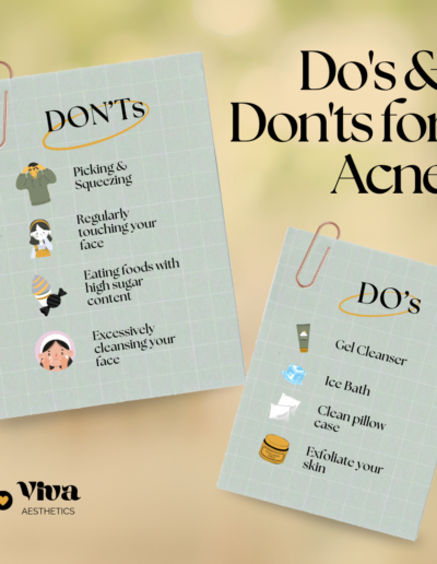 dos and donts for acne
